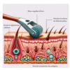 Derma Roller - Thumbnail Image 3
